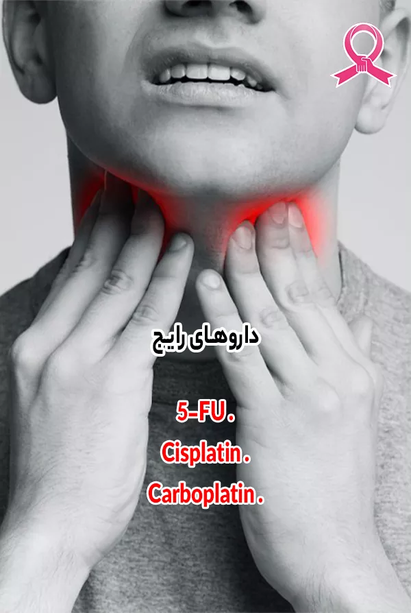 داروهای شیمی درمانی در سرطان گلو