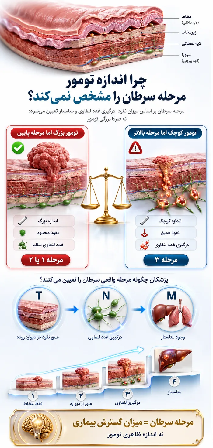 اینفوگرافیک چرا اندازه تومور مرحله سرطان را مشخص نمیکند؟