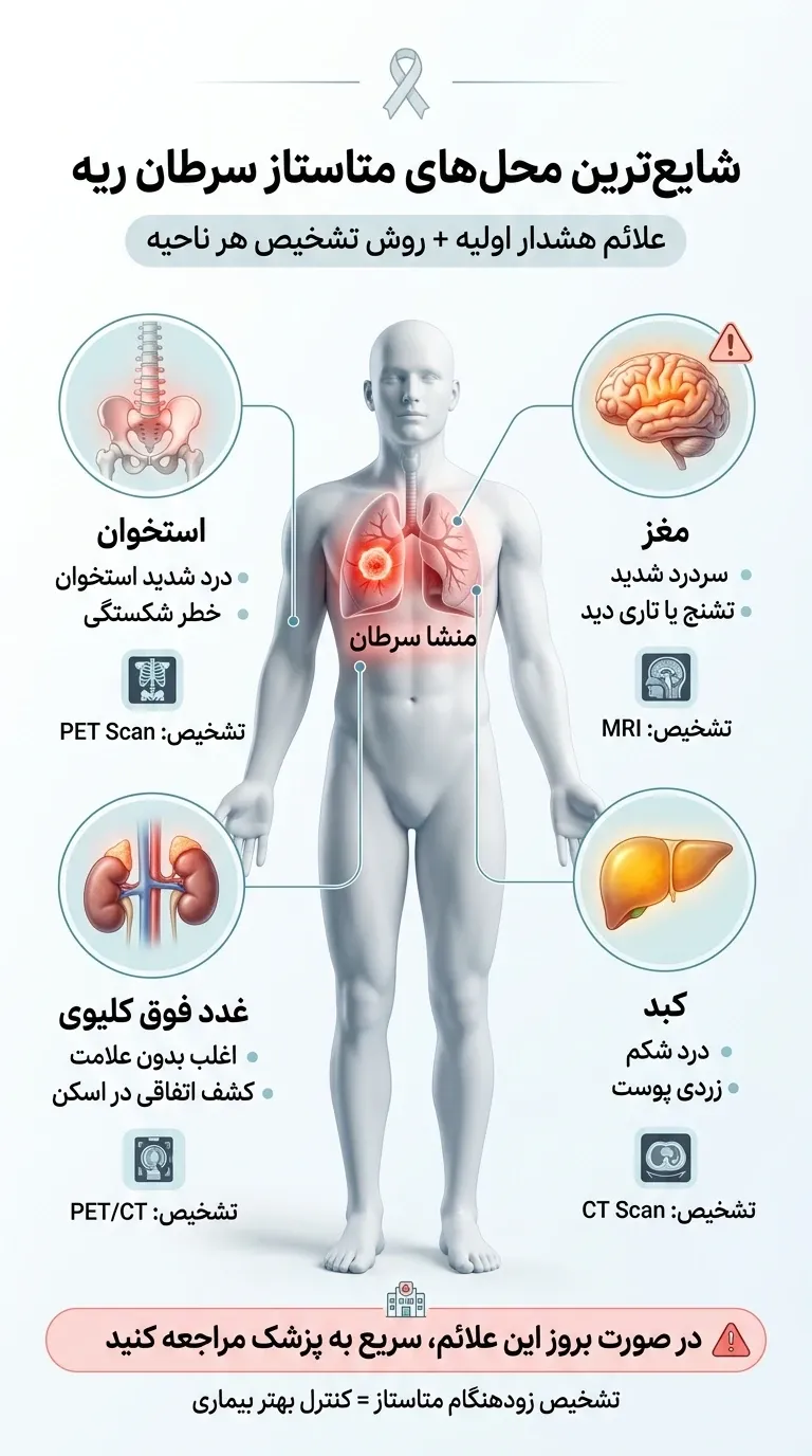 اینفوگرافیک شایع ترین محل های متاستاز سرطان ریه