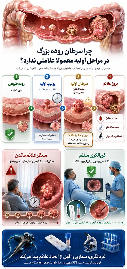 اینفوگرافیک چرا سرطان روده بزرگ در مراحل اولیه معمولا علامتی ندارد؟