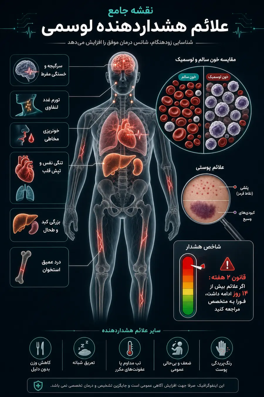 مهمترین علائم سرطان خون کدام است؟